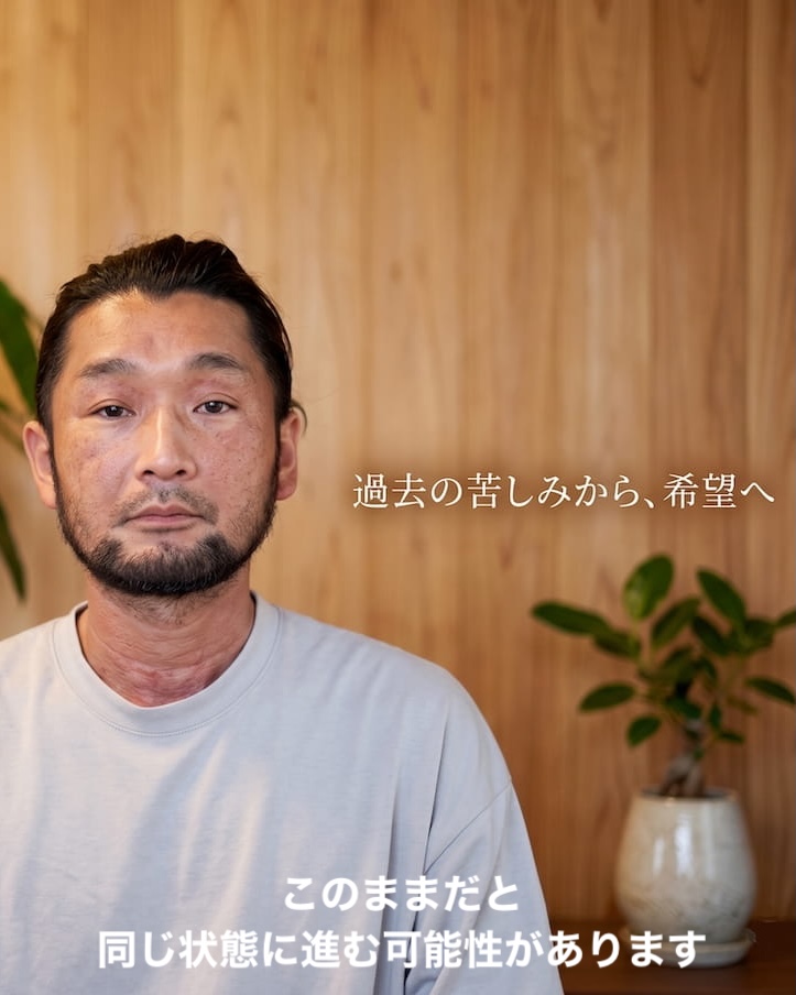 3年前 全身アトピーの状態 院長 大谷聡